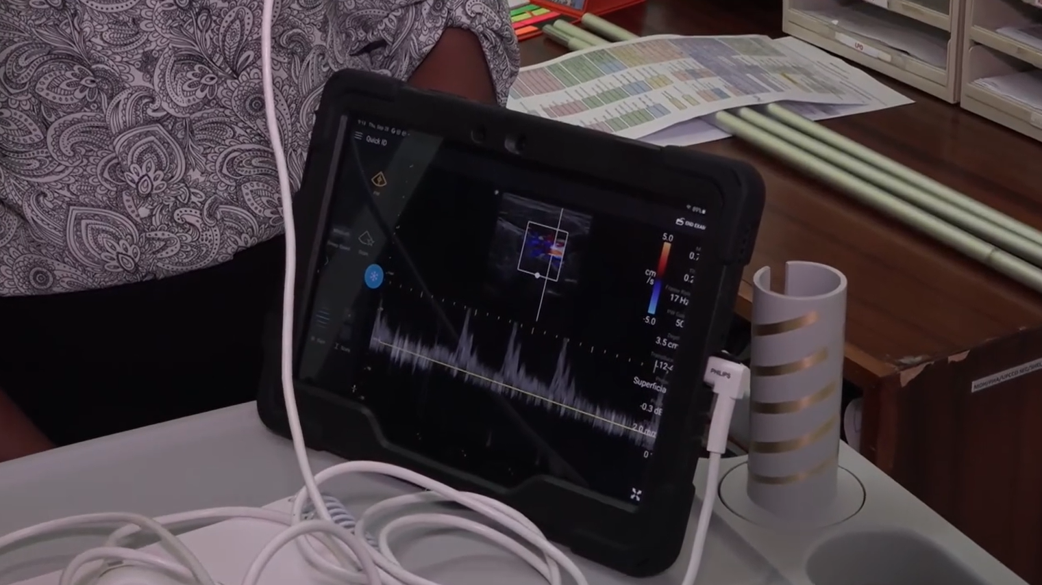 Minister Lasante in resevwar en ‘Ultrasound’ portab