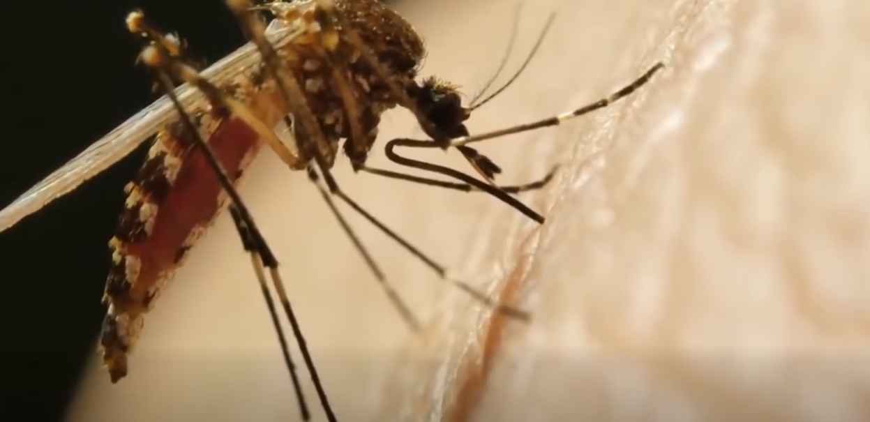 Mizazour lepidemi lafyev/Mpox Mizazour lepidemi lafyev/Mpox